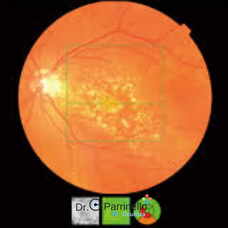 Tomografia coerenza ottica O.C.T., oculista convenzioanto a Marsala