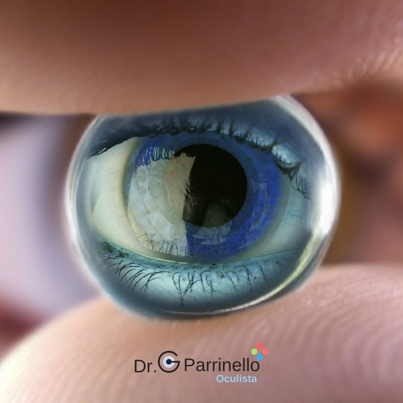 Vitrectomia, oculista convenzioanto a Marsala