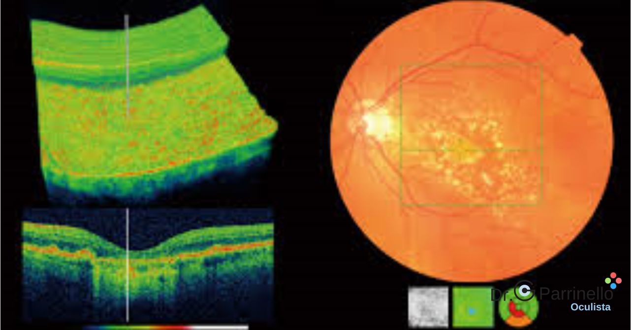 Tomografia coerenza ottica O.C.T. Diagnosi ed esami visivi - oculista Marsala Tomografia coerenza ottica O.C.T.