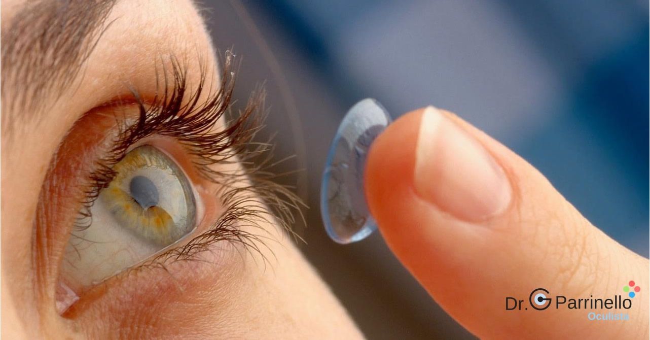 Patologie corneali da lenti a contatto Patologie dell'occhio - oculista Marsala Patologie corneali da lenti a contatto